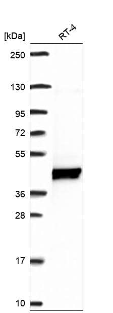 KIST Antibody Western Blot: KIST Antibody [NBP3-24941]