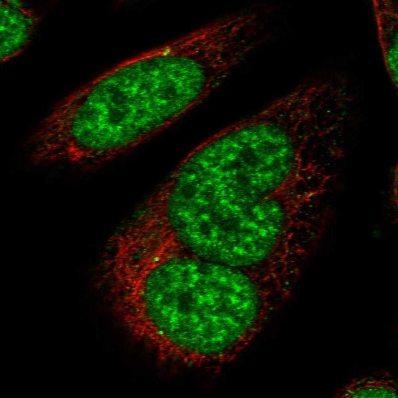 KIST Antibody Immunocytochemistry/Immunofluorescence: KIST Antibody [NBP3-24941]