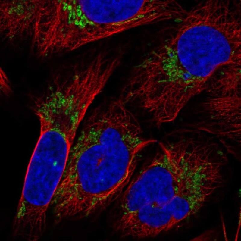 KLHL29 Antibody Immunocytochemistry/Immunofluorescence: KLHL29 Antibody [NBP3-24942]