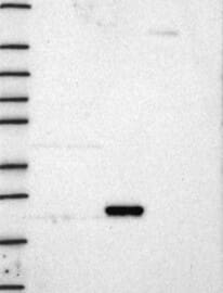 KRAS Antibody Western Blot: KRAS Antibody [NBP3-24943]