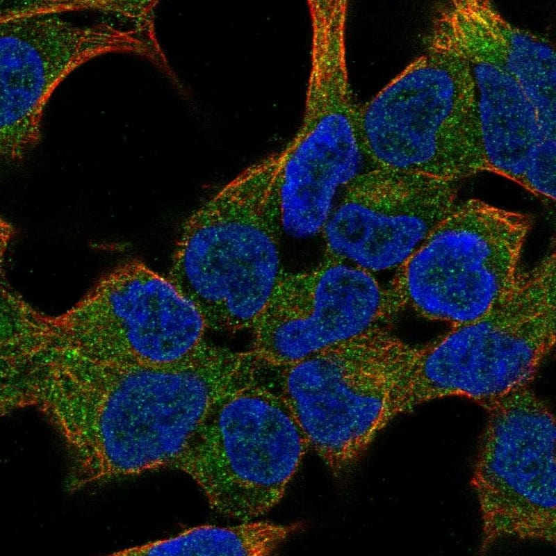KRAS Antibody Immunocytochemistry/Immunofluorescence: KRAS Antibody [NBP3-24943]