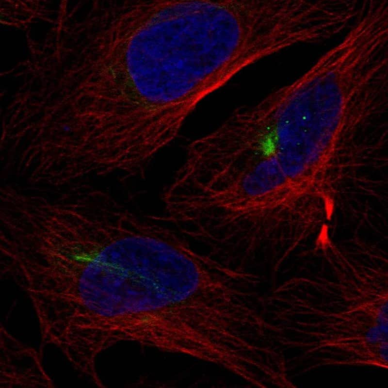 KRT74 Antibody Immunocytochemistry/Immunofluorescence: KRT74 Antibody [NBP3-24944]