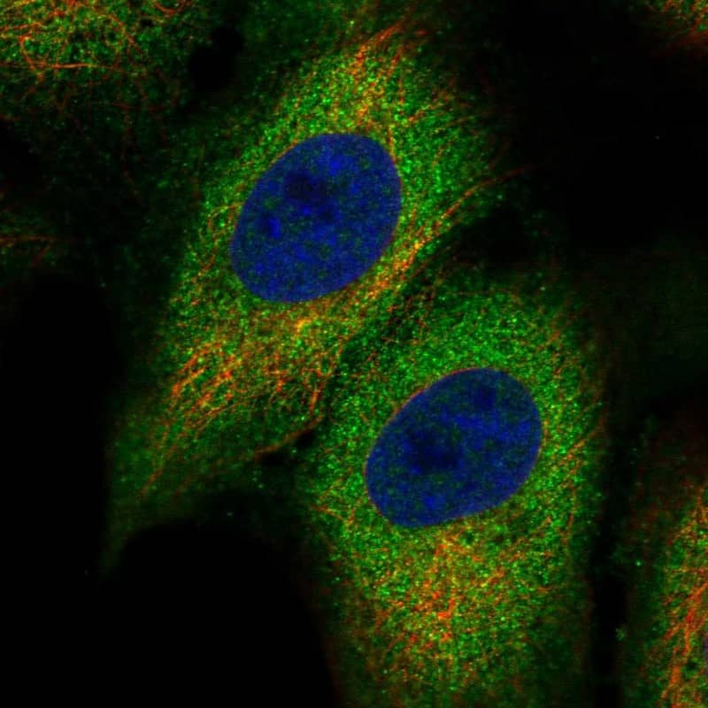 Kv1.6 Antibody Immunocytochemistry/Immunofluorescence: Kv1.6 Antibody [NBP3-24946]