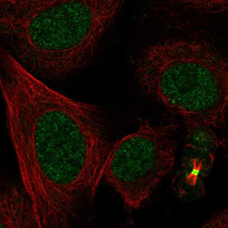 L3MBTL1 Antibody Immunocytochemistry/Immunofluorescence: L3MBTL1 Antibody [NBP3-24950]