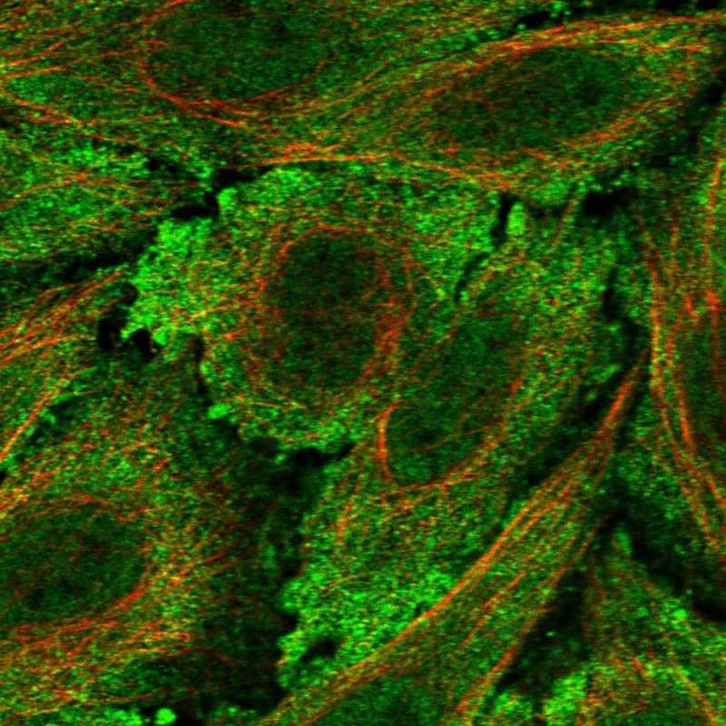 LCA5L Antibody Immunocytochemistry/Immunofluorescence: LCA5L Antibody [NBP3-24951]