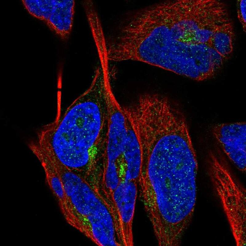 Lebercilin Antibody Immunocytochemistry/Immunofluorescence: Lebercilin Antibody [NBP3-24952]