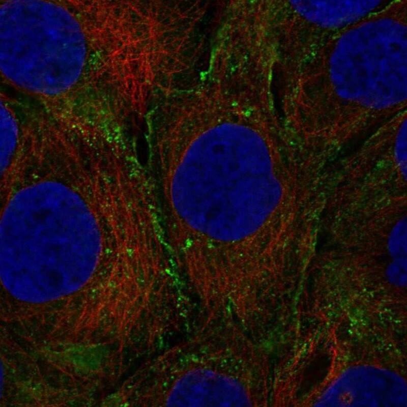 Leptin/OB Antibody Immunocytochemistry/Immunofluorescence: Leptin/OB Antibody [NBP3-24954]