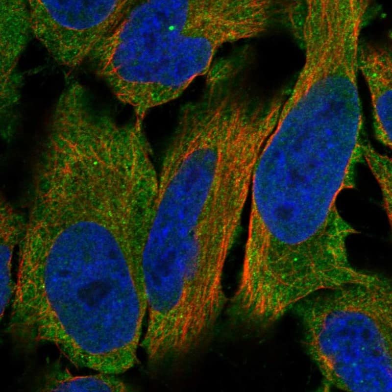 LHR Antibody Immunocytochemistry/Immunofluorescence: LHR Antibody [NBP3-24955]