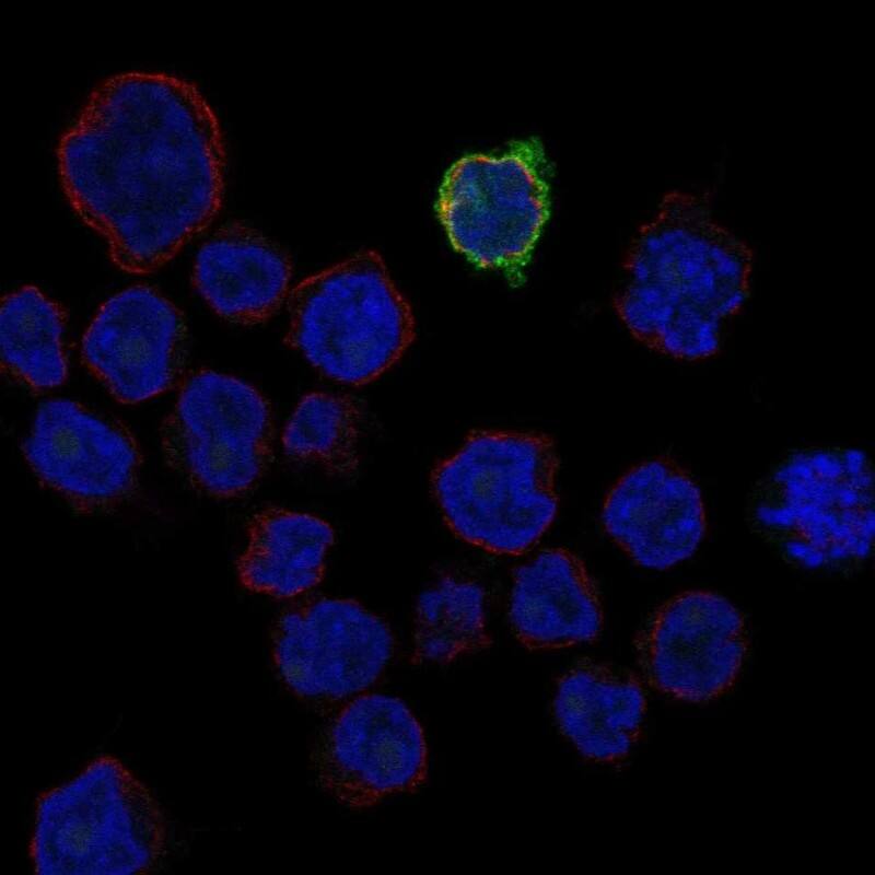 Lipase I Antibody Immunocytochemistry/Immunofluorescence: Lipase I Antibody [NBP3-24956]