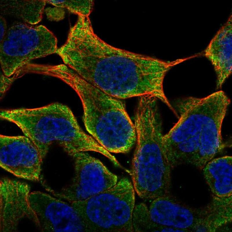 LIPM Antibody Immunocytochemistry/Immunofluorescence: LIPM Antibody [NBP3-24957]