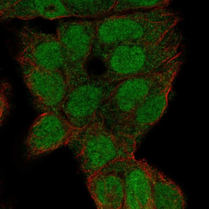 LMX1b Antibody Immunocytochemistry/Immunofluorescence: LMX1b Antibody [NBP3-24958]