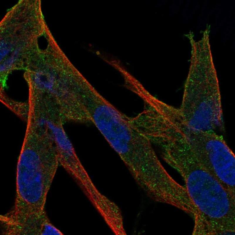 LRCH2 Antibody Immunocytochemistry/Immunofluorescence: LRCH2 Antibody [NBP3-24960]