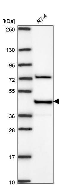 LRPAP Antibody Western Blot: LRPAP Antibody [NBP3-24961]