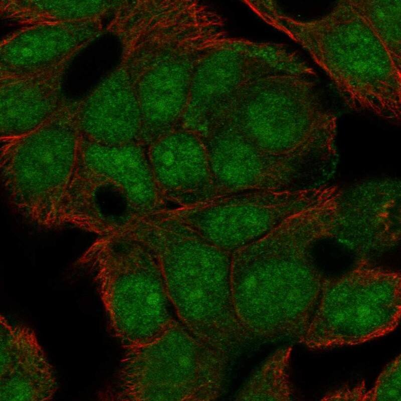 LRRC31 Antibody Immunocytochemistry/Immunofluorescence: LRRC31 Antibody [NBP3-24963]