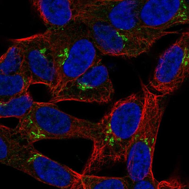 LRRTM1 Antibody Immunocytochemistry/Immunofluorescence: LRRTM1 Antibody [NBP3-24964]