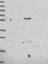 MARCH1 Antibody Western Blot: MARCH1 Antibody [NBP3-24968]