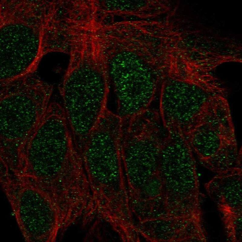 MATH1 Antibody Immunocytochemistry/Immunofluorescence: MATH1 Antibody [NBP3-24969]