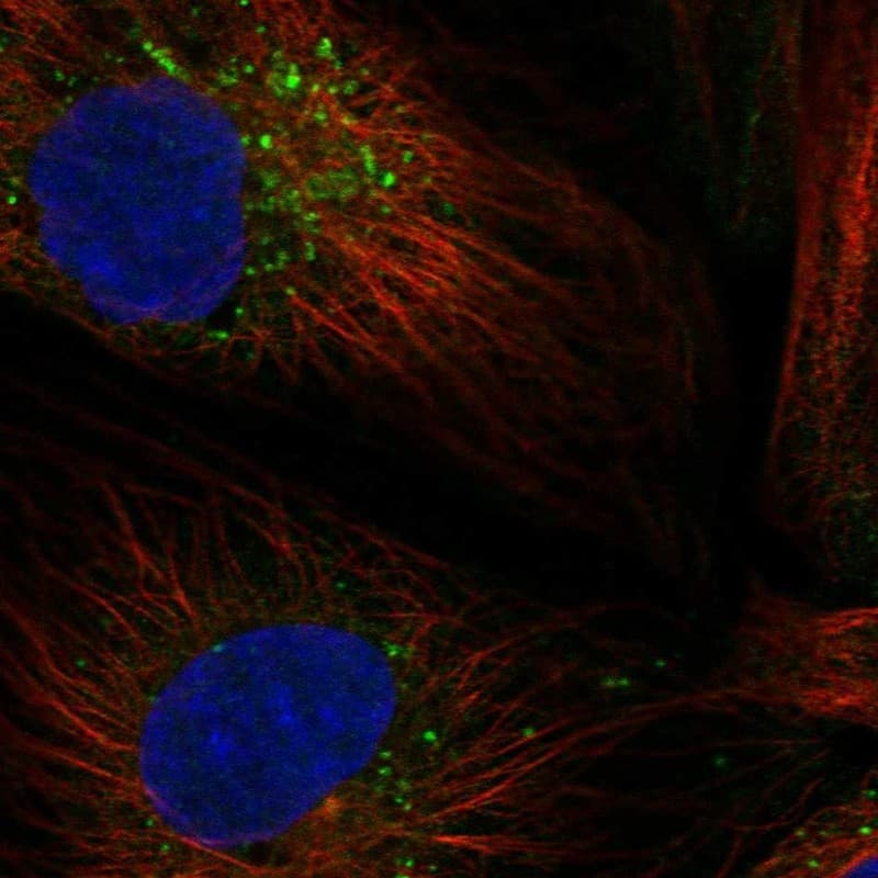 MATN3 Antibody Immunocytochemistry/Immunofluorescence: MATN3 Antibody [NBP3-24971]