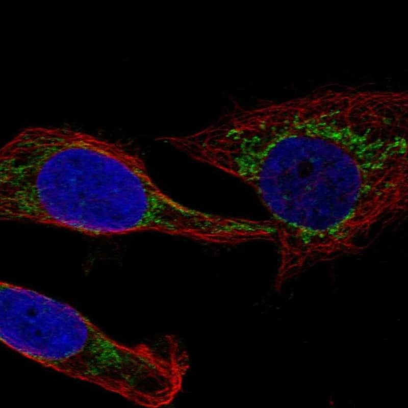 MCCC1 Antibody Immunocytochemistry/Immunofluorescence: MCCC1 Antibody [NBP3-24973]