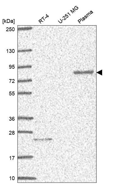 MCTP1 Antibody Western Blot: MCTP1 Antibody [NBP3-24975]