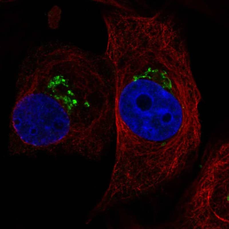 MCTP1 Antibody Immunocytochemistry/Immunofluorescence: MCTP1 Antibody [NBP3-24975]