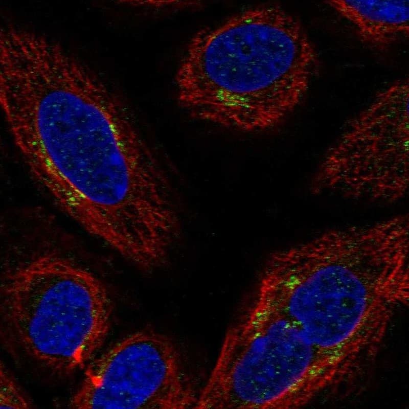 MDS028 Antibody Immunocytochemistry/Immunofluorescence: MDS028 Antibody [NBP3-24976]