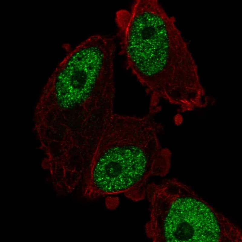 MED26 Antibody Immunocytochemistry/Immunofluorescence: MED26 Antibody [NBP3-24977]