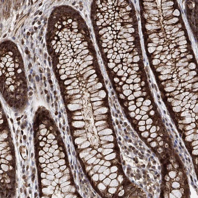 MEKK3 Antibody Immunohistochemistry-Paraffin: MEKK3 Antibody [NBP3-24979]