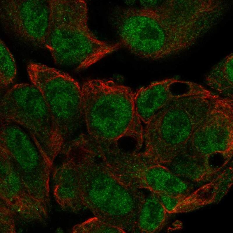 Methyltransferase like 3 Antibody Immunocytochemistry/Immunofluorescence: Methyltransferase like 3 Antibody [NBP3-24980]