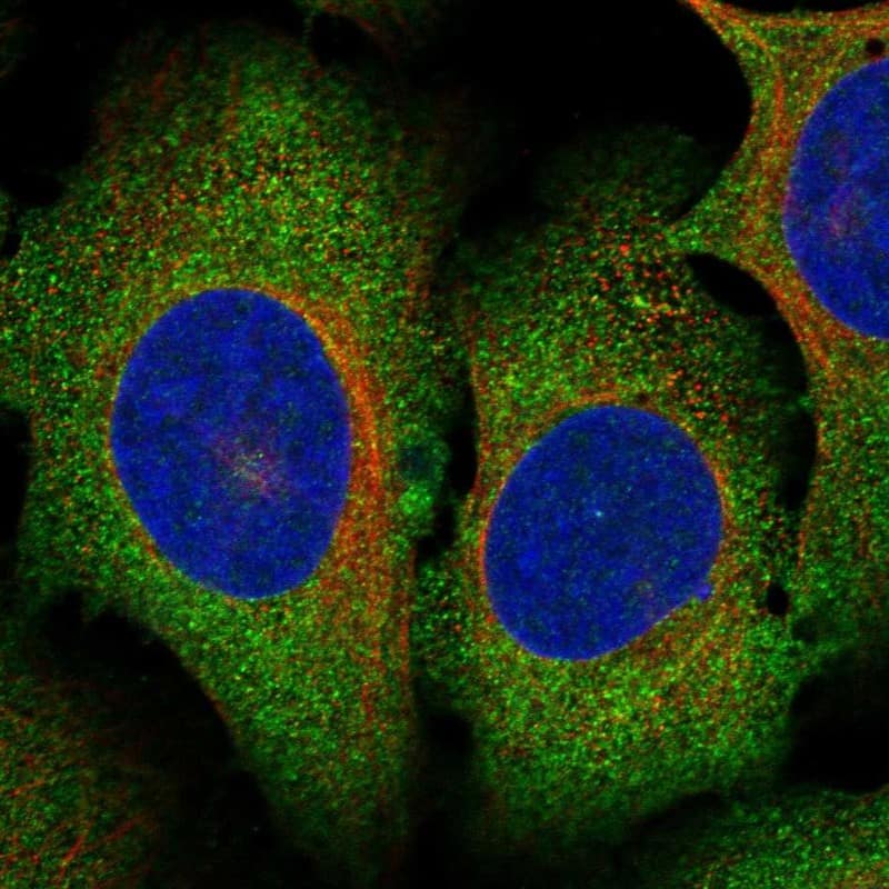 METTL13 Antibody Immunocytochemistry/Immunofluorescence: METTL13 Antibody [NBP3-24981]