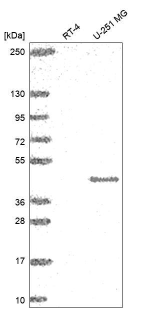 MFSD4 Antibody Western Blot: MFSD4 Antibody [NBP3-24982]