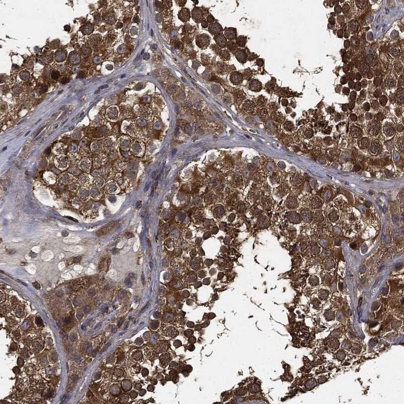 MIER2 Antibody Immunohistochemistry-Paraffin: MIER2 Antibody [NBP3-24983]