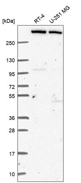 MLL3 Antibody Western Blot: MLL3 Antibody [NBP3-24985]