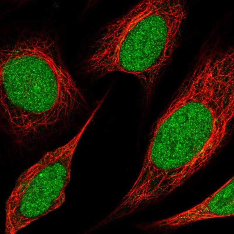 MLL3 Antibody Immunocytochemistry/Immunofluorescence: MLL3 Antibody [NBP3-24985]