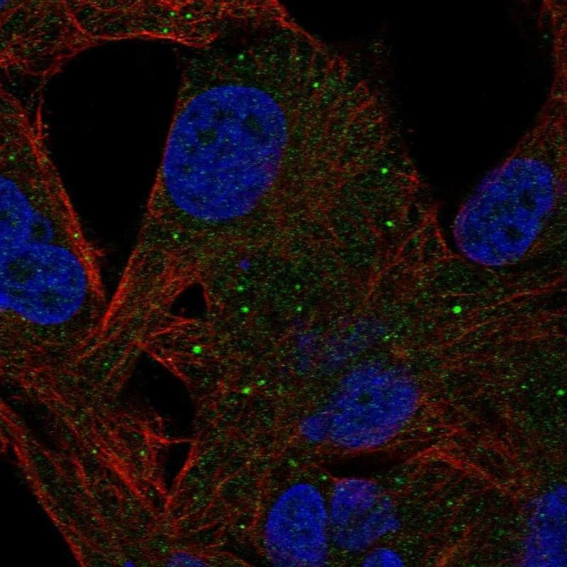 MMP-8 Antibody Immunocytochemistry/Immunofluorescence: MMP-8 Antibody [NBP3-24986]