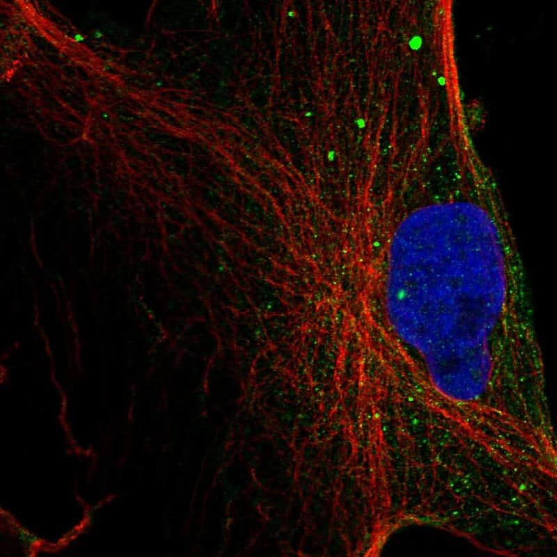 Monoglyceride Lipase Antibody Immunocytochemistry/Immunofluorescence: Monoglyceride Lipase Antibody [NBP3-24988]