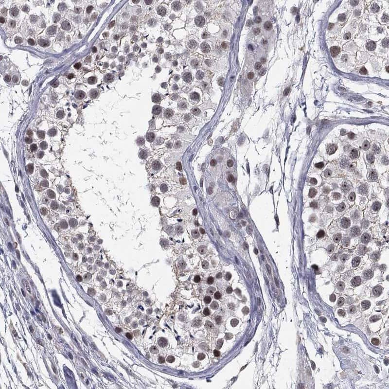 MORC2 Antibody Immunohistochemistry-Paraffin: MORC2 Antibody [NBP3-24989]