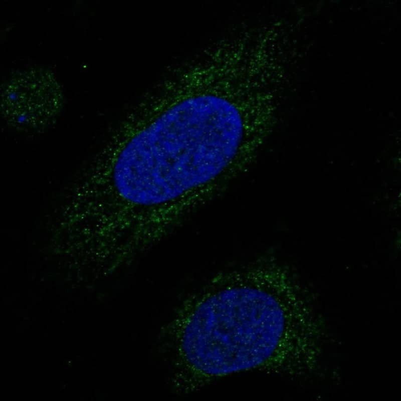 MRPL38 Antibody Immunocytochemistry/Immunofluorescence: MRPL38 Antibody [NBP3-24992]