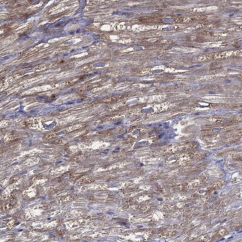 MRPL46 Antibody Immunohistochemistry-Paraffin: MRPL46 Antibody [NBP3-24993]