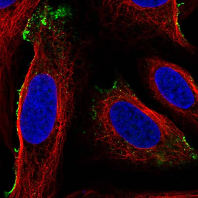 MSP/MST1 Antibody Immunocytochemistry/Immunofluorescence: MSP/MST1 Antibody [NBP3-24996]