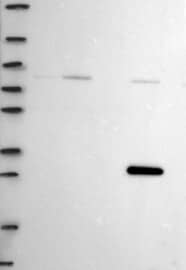 MST2/STK3 Antibody Western Blot: MST2/STK3 Antibody [NBP3-24997]