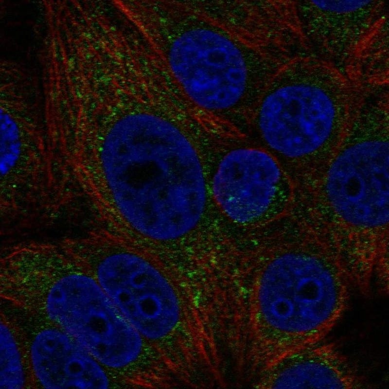 MTMR1 Antibody Immunocytochemistry/Immunofluorescence: MTMR1 Antibody [NBP3-24998]