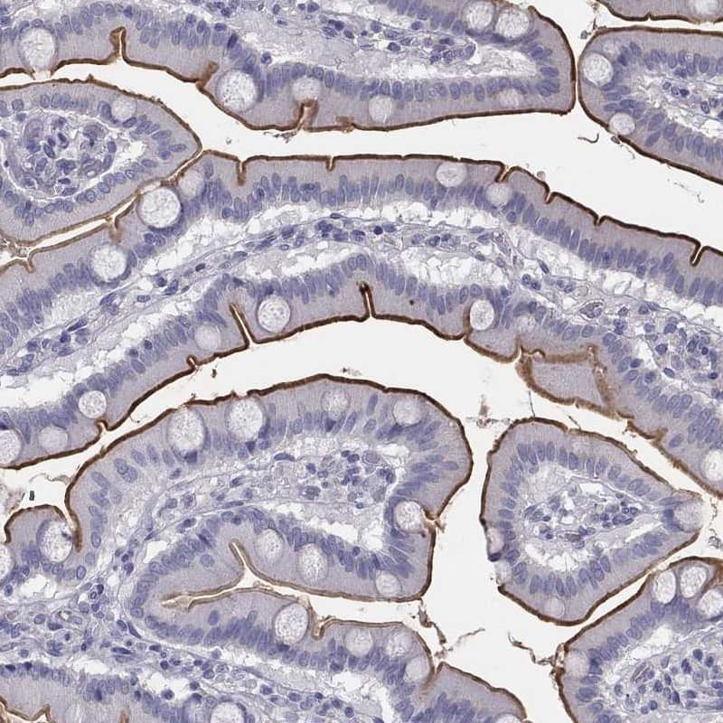 MUC13 Antibody Immunohistochemistry-Paraffin: MUC13 Antibody [NBP3-24999]