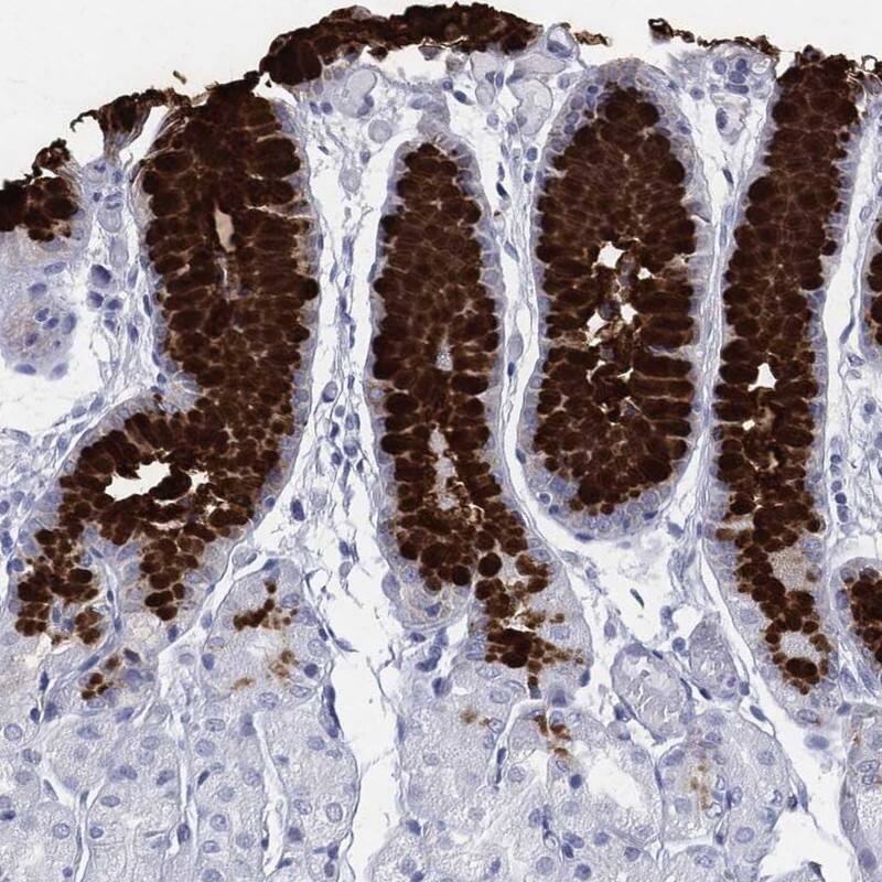 MUC5AC Antibody Immunohistochemistry-Paraffin: MUC5AC Antibody [NBP3-25000]