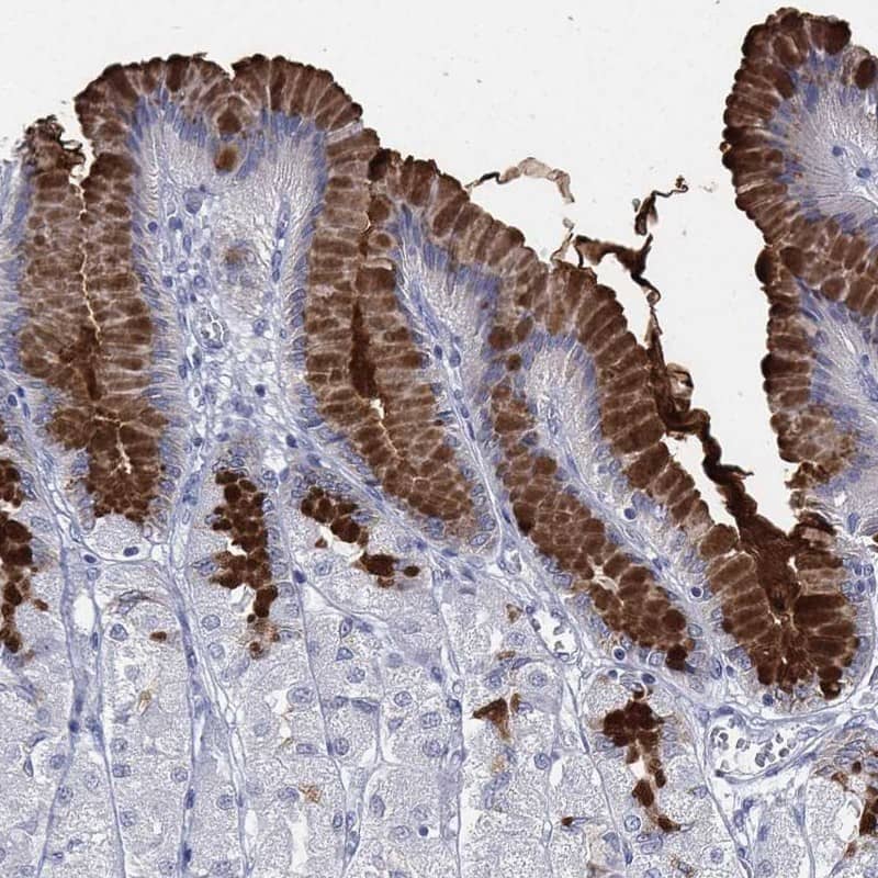 MUC5AC Antibody Immunohistochemistry-Paraffin: MUC5AC Antibody [NBP3-25001]