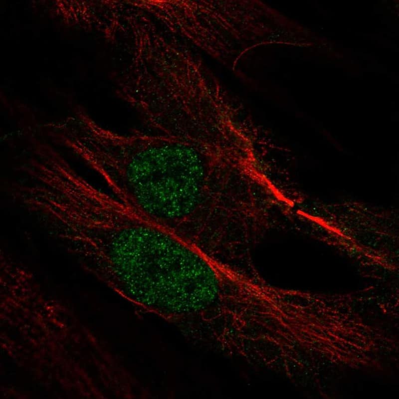 MYF6 Antibody Immunocytochemistry/Immunofluorescence: MYF6 Antibody [NBP3-25003]