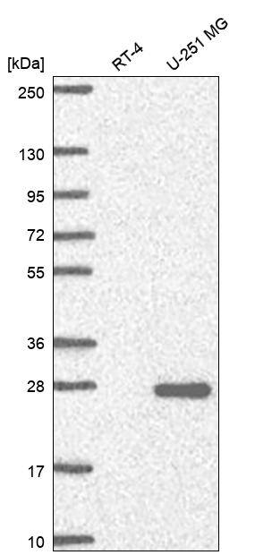 NCCRP1 Antibody Western Blot: NCCRP1 Antibody [NBP3-25005]