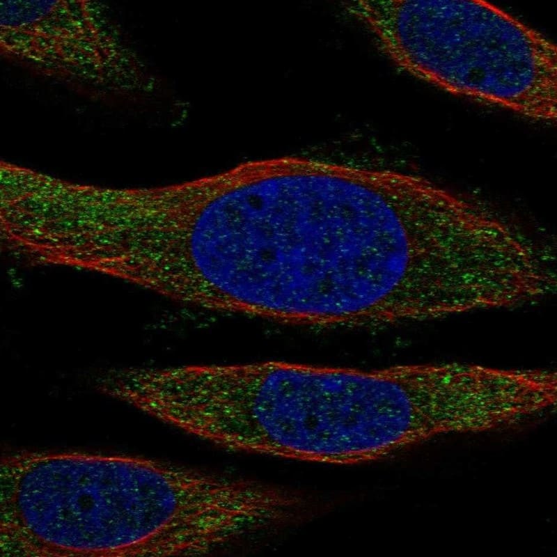 NCCRP1 Antibody Immunocytochemistry/Immunofluorescence: NCCRP1 Antibody [NBP3-25005]