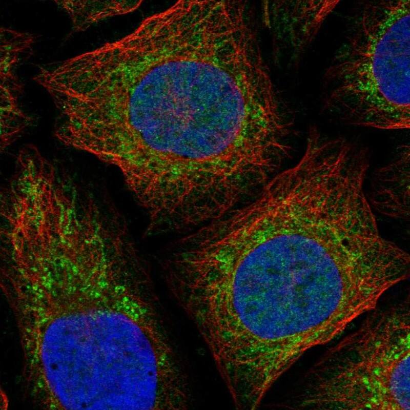 NDUFAF4 Antibody Immunocytochemistry/Immunofluorescence: NDUFAF4 Antibody [NBP3-25007]