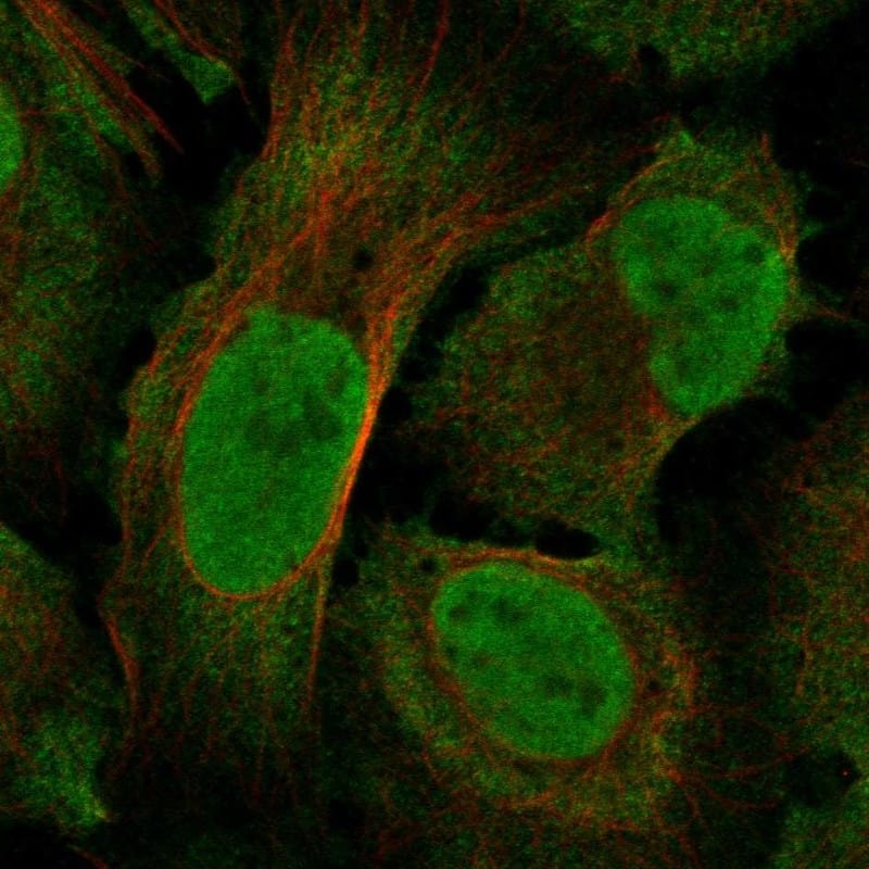 Neurofibromin 1 Antibody Immunocytochemistry/Immunofluorescence: Neurofibromin 1 Antibody [NBP3-25009]